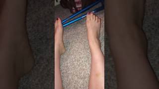 Sprained ankle!