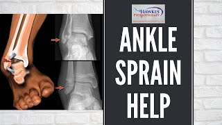 Lateral ankle sprain treatment & rehabilitation exercises video