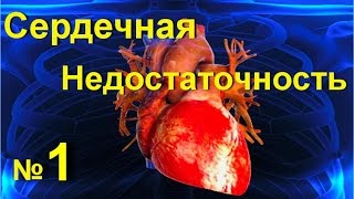 Сердечная недостаточность ! Как лечить сердечную недостаточность  № 1! Лечение сердца