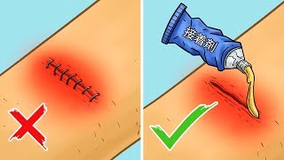 あなたの命を救う、１２の応急処置
