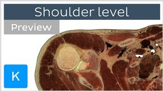 Cross section of upper extremity - shoulder (preview) - Human Anatomy | Kenhub