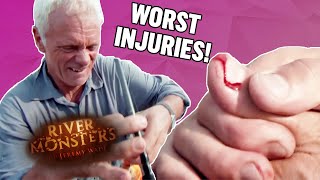 Worst Injuries: Part 1 - River Monsters