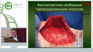 Фесенко В Н - Хирургическая коррекция пола