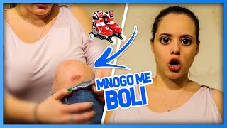 KAKO SAM PALA SA ROLERA I OPET POVREDILA KOLENO?