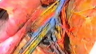 ПОДМЫШЕЧНАЯ ОБЛАСТЬ - ДВГМУ