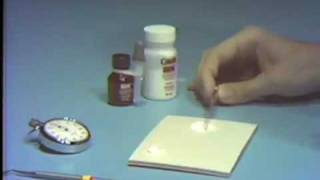 Zinc Oxide-Eugenol: Intermediate Restorative Material