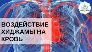 Воздействие хиджамы на кровь | Обучение хиджаме