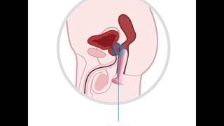 Vibrating Anal Plug and Prostate Massager SKAVOM