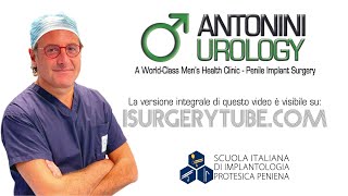 Androprotesi Andrologia Urologo Andrologo Roma Protesi Pene Dott Gabriele Antonini Urologo Andrologo