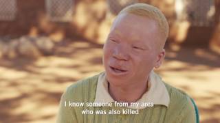 Malawi: Hunted for their body parts