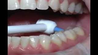 the optimal use of Water Pick