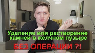 Можно ли избавиться от камней в желчном пузыре без операции?