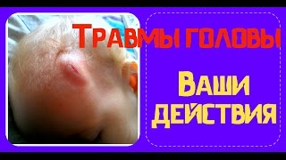 Помощь ребенку при ударе головой