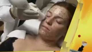 Русалина в документальном фильме "Красота без жертв"