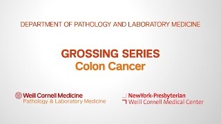 Grossing Colon Pathology Specimens | Department of Pathology and Laboratory Medicine