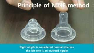 Inverted Nipple : No incision Nipple Eversion [AONE Clinic]