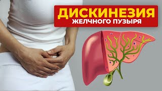 Дискинезия желчного пузыря - симптомы, причины, лечение. Ольга Спиридонова